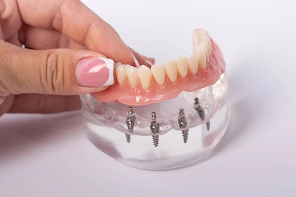 Hand holding a model of teeth