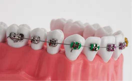 Patient smiling with metal braces