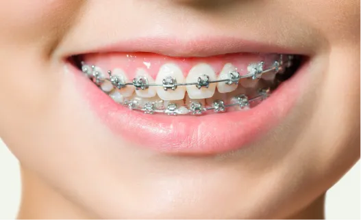 Orthodontic patient consultation